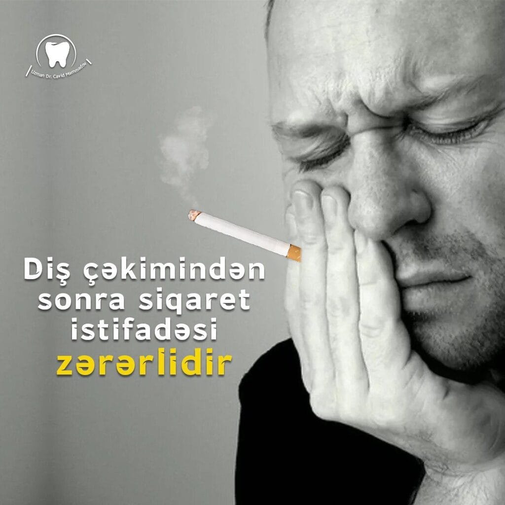 Dis cəkimindən sonra siqaret Istifadəsi zərərlidir