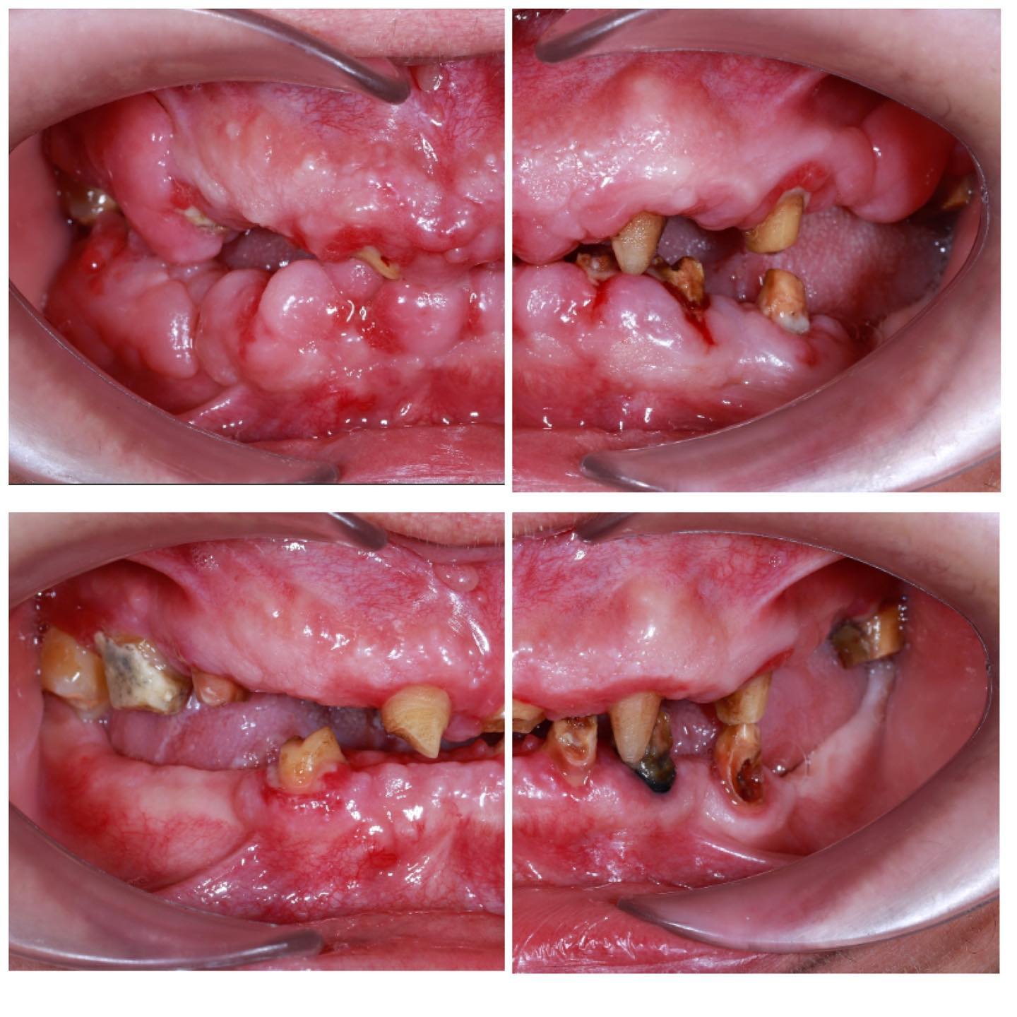 Epulusların götürülməsi