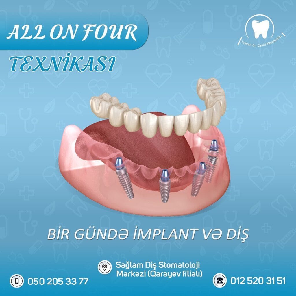 All on four texnikasi