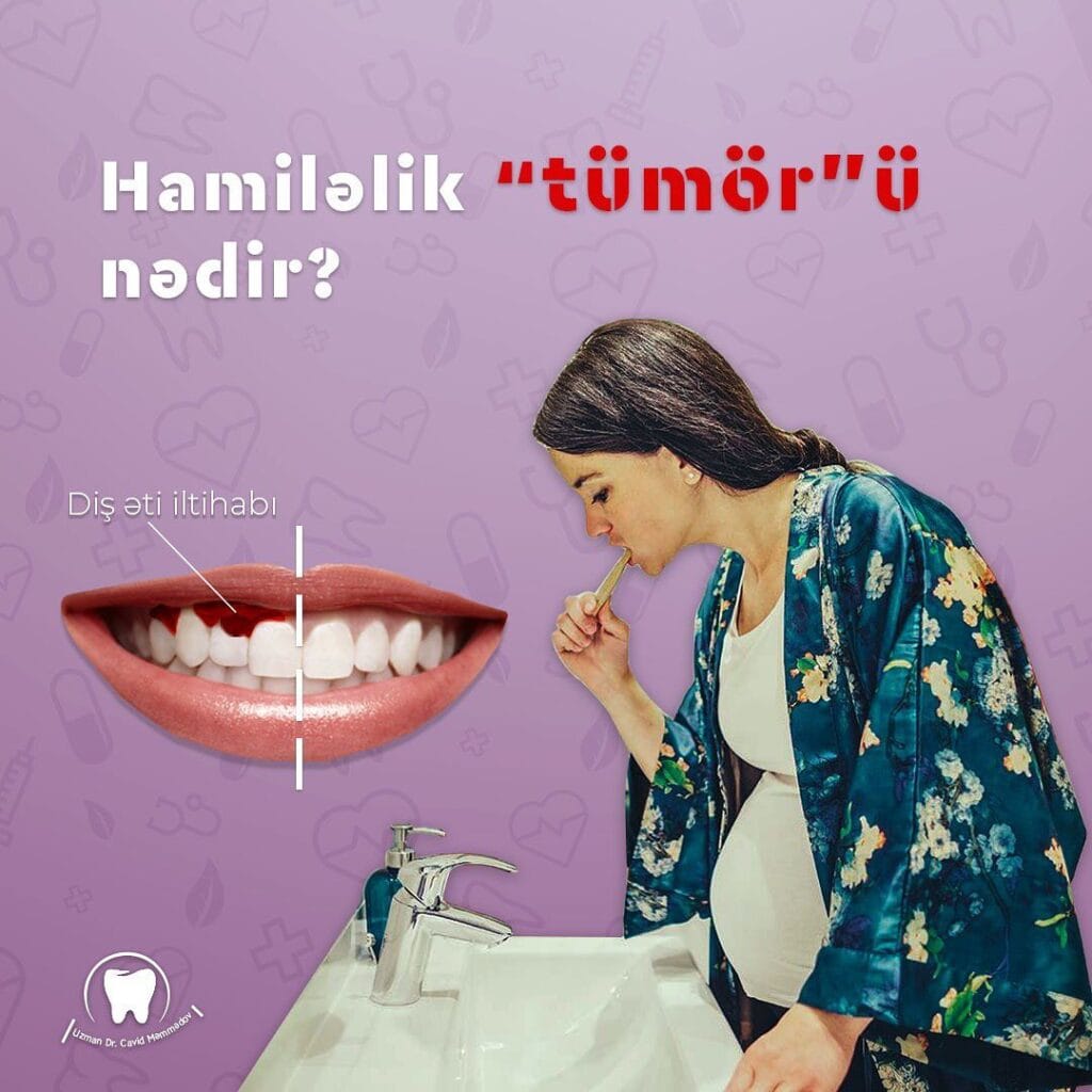 Hamiləlik tumoru nədir