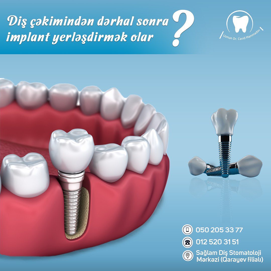 derhal-dental-implant