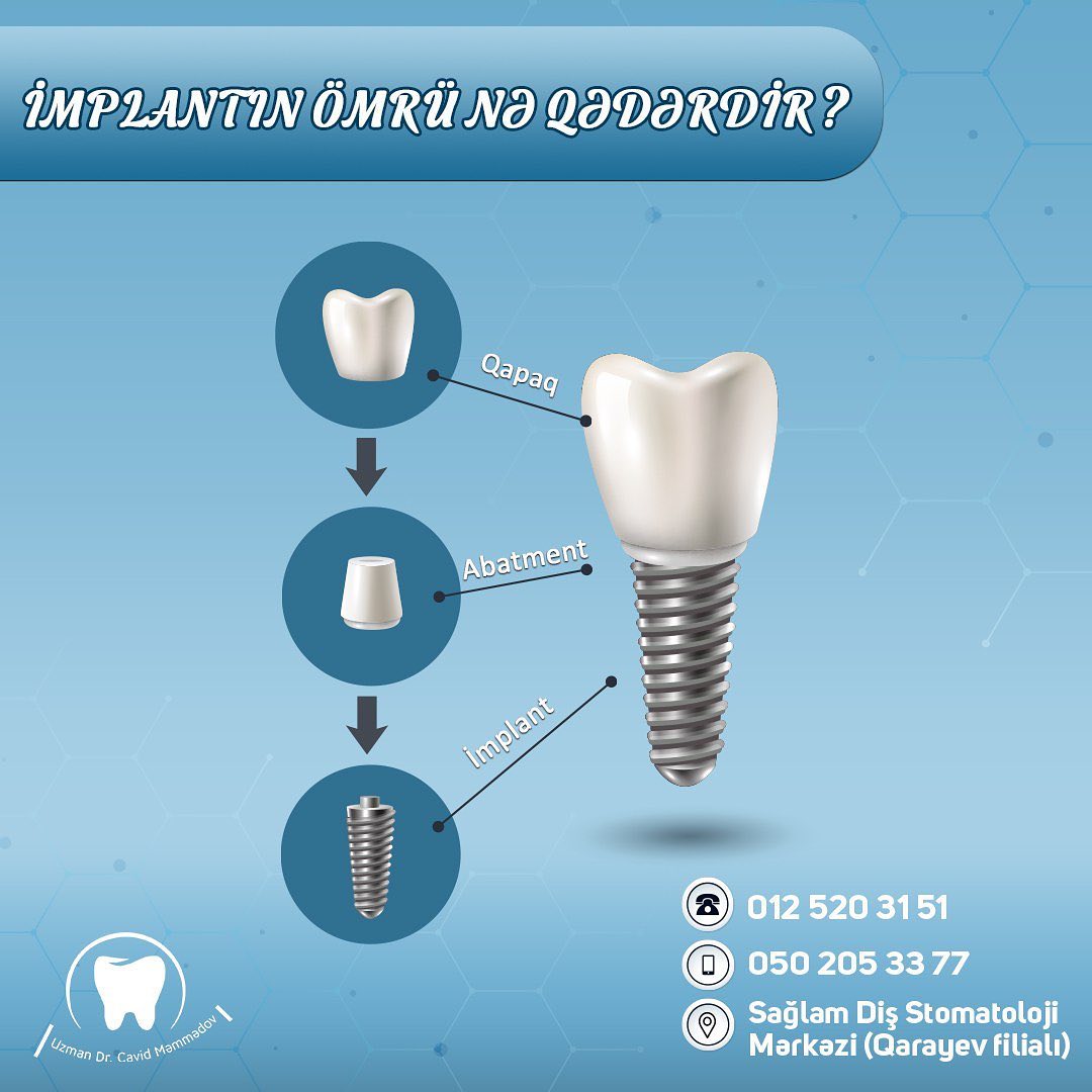 implantin-omru